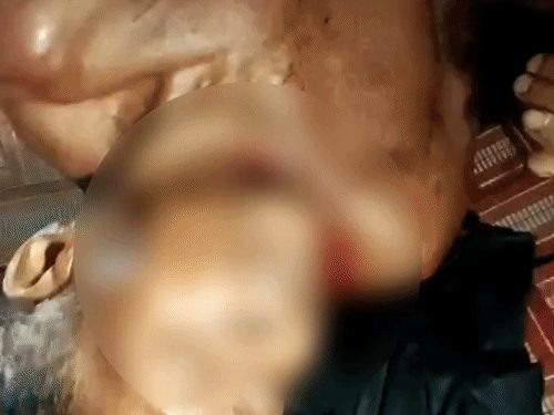 सूरजपुर में 65 वर्षीय चौकीदार से रेप के बाद नाबिग ने सब्बल और ब्लेड से की हत्या, आरोपी की मौके पर मौत